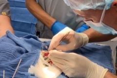 Manicotti Sea Turtle Surgery