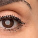 How Cataracts Impact Vision Quality